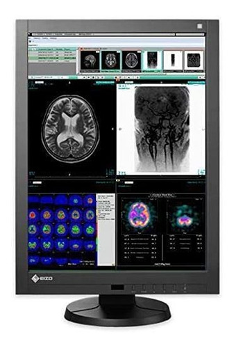 Renovado® Eizo Radiforce Rx340 3mp Color Medical Led Diagnos