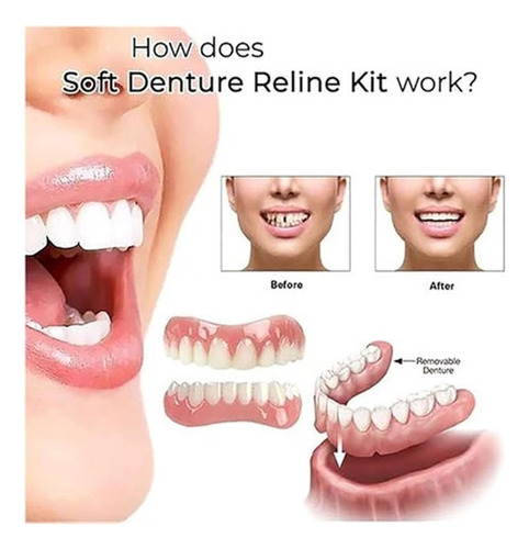Fa Kit De Silicona De Dentadura Postiza Fácil De Usar