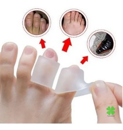 Imagem 9 de 10 de Dedeira Silicone Anti-sensibilidade Joanete Atrito Calos Pes