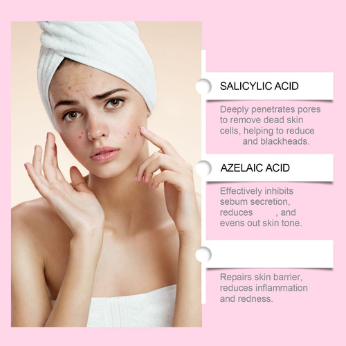 Azelaico Azelaico Face Hialurônico Para Aliviar A Vermelhidã