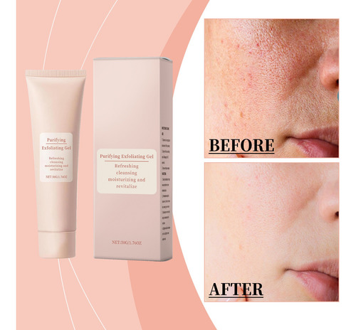 Crema Limpiadora Facial U Refrescante Y Con Control De Aceit
