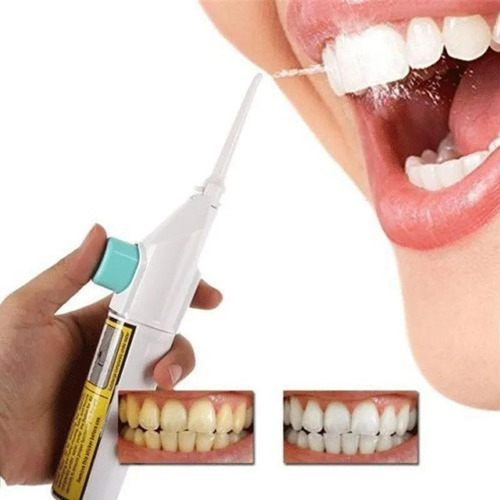 Fio Dental Portátil Higiene Irrigado Limpeza Bocal Água Jato