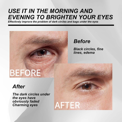 Olhos Hidratantes E Vitalizantes Masculinos Reduzem O Cir Pr