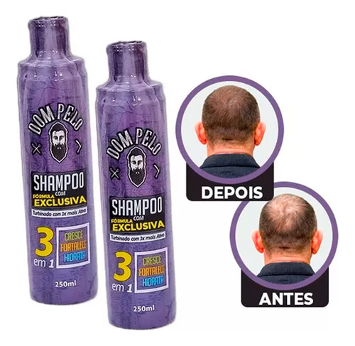 2 Shampoo Nixidil Fortificante 3 Em 1 - Dom Pelo 250ml