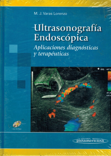 Ultrasonografía Endoscópica - Varas Lorenzo