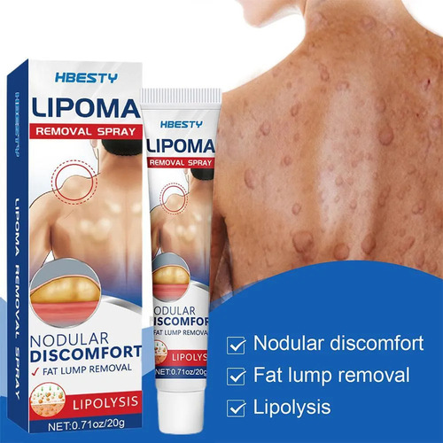 - Crema Para Eliminar Lipomas, Crema Limpiadora De Lipomas