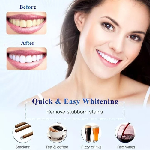 Gel Dental Blanqueador De Dientes