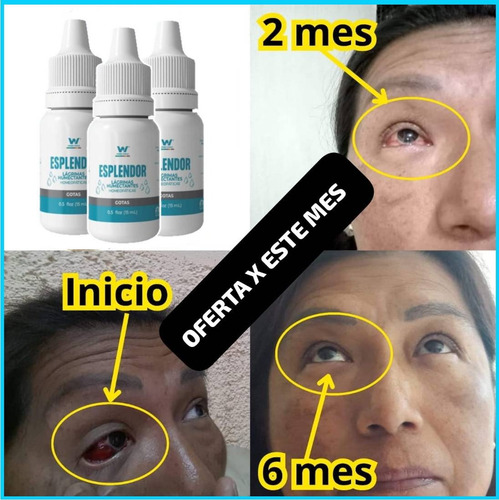 Esplendor, Gotas Para Cuidar Tus Ojos
