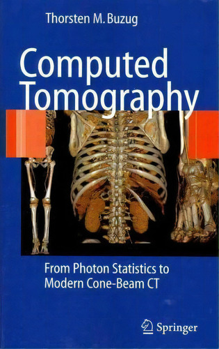 Computed Tomography : From Photon Statistics To Modern Cone-beam Ct, De Thorsten M. Buzug. Editorial Springer-verlag Berlin And Heidelberg Gmbh & Co. Kg, Tapa Blanda En Inglés