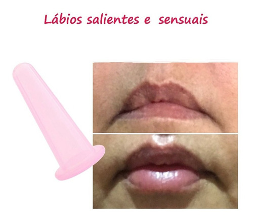 Preenchimento Lábios Boca Volumosa Lip Pumper Aparelho