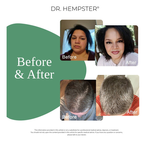Champô Anti-queda De Cabelo Com Biotina Para Homens E Mul...