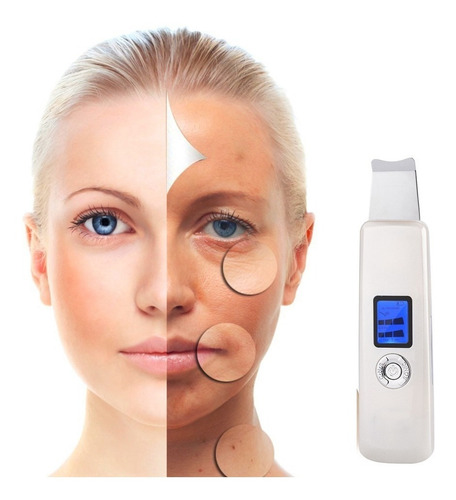 Espatula Peeling Masajeadora Facial Ultrasonica Acne Cuotas