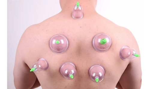 12 Ventosas Neumáticas + Equipo De Vacumterapia