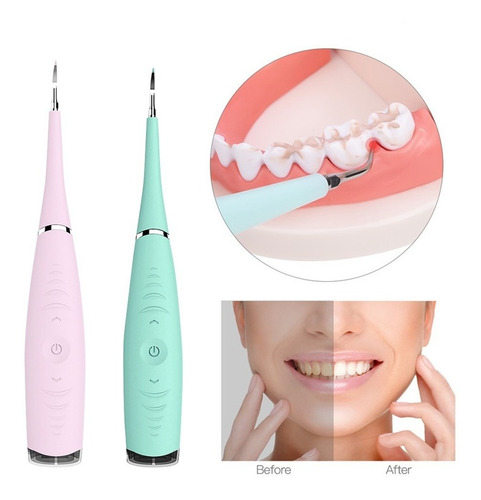 Imagen 5 de 7 de Limpiador Dental Ultrasónico Recargable Resistente Al Agua