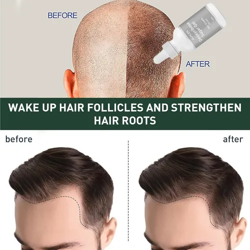 Deoxyribose Sugar Gel Hair, Deoxyribose Gel For Hair Loss,1