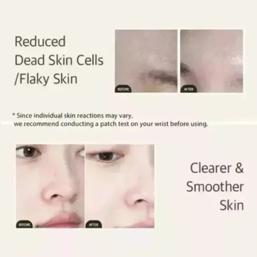 Nuevo Producto Exfoliante Facial Fb Essence Mixsoon Essence
