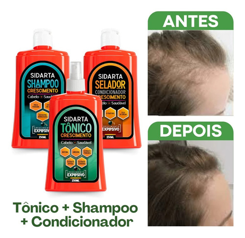Kit Das Famosas: Tônico Sidarta, Shampoo E Condicionador