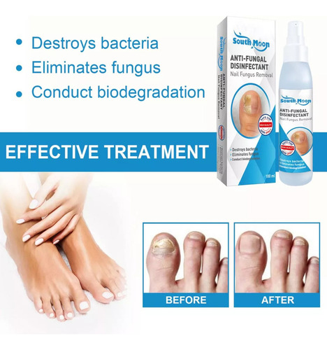- Spray Reparador De Uñas, Repara Y Limpia Uñas, Manos, Pies