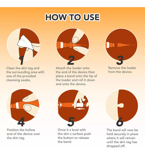 Skin Tag Removal Kit For Face, Neck And Body