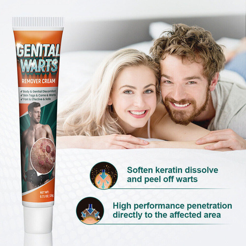 Crema Para Eliminar Verrugas Genitales Partes Privadas, 3 Un