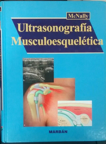 Ultrasonografia Musculoesqueletica De: Eugene Mcnally.