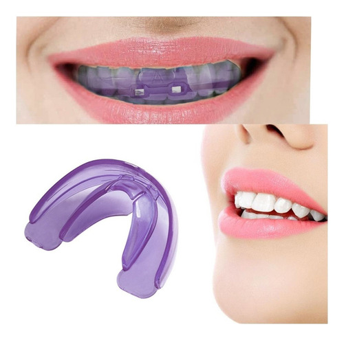 Asd Aparatos Ortodóncicos Dentales Alineación De Dientes