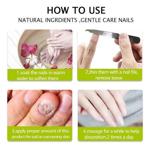 3 Piezas De Gel Para Tratamiento De Hongos En Las Uñas