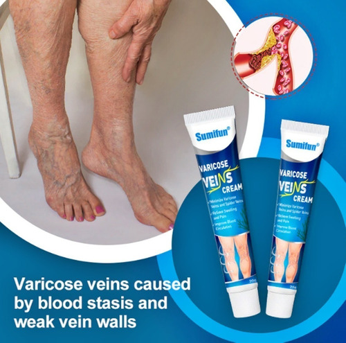 Kit 8 Creme Para Varizes Varicose Spider Ab111 Treatment