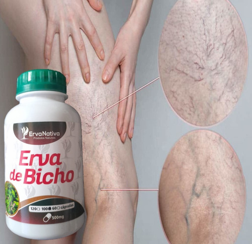 Remedio De Hemorroidas Verizes Veias Combo+chá Sabor Neutro