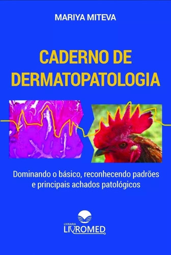 Caderno De Dermatopatologia