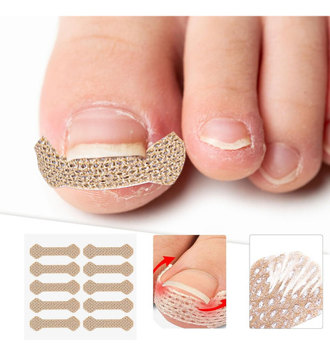 100 Pegatinas Correctoras Para Uñas Encarnadas