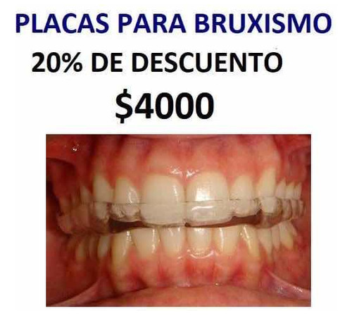 Imagen 5 de 5 de Ortodoncia. Consultorio Dental