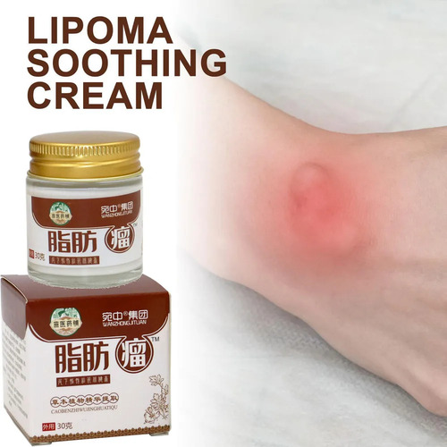 Creme De Remoção De Lipomas À Base De Ervas, Creme. -