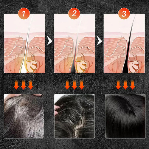 Jabón En Barra Para Cubrir Y Revertir Las Canas: Champú