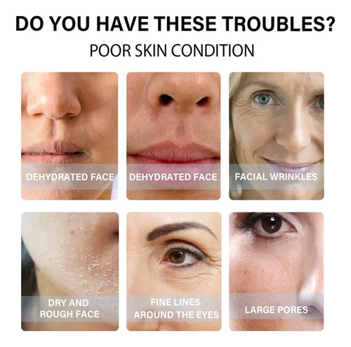 Hilo De Proteína Soluble Coreano Proform, Hilo De Colágeno