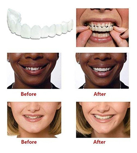 23 1 Par De Dentes Cosméticos Temporary Smile Fit Indent