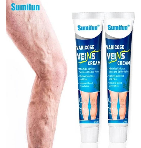 Crema Quita Varices Super Efectiva Desinflama Alivia Hierbas