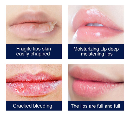 El Lápiz Labial Para Hombre Hidrata E Hidrata Los Labios, Pr