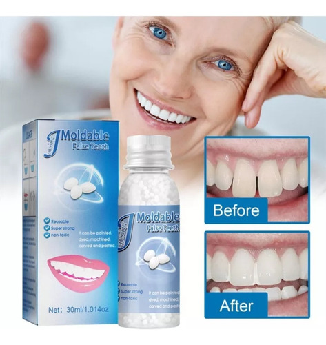 Kit Temporal: Huecos Para Dientes Falsos, Adhesivos Sólidos