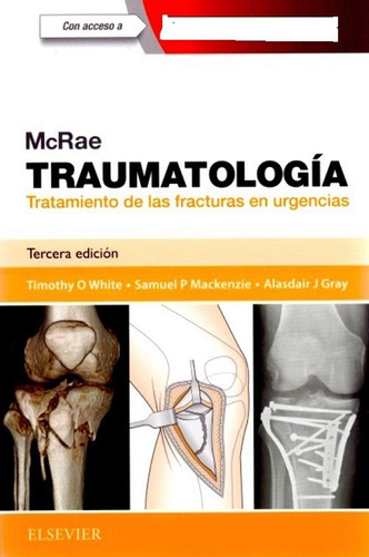 Traumatología Tratamiento De Las Fracturas En Urgencias 3era Edición, De White O. Timothy. Editorial Elsevier, Tapa Blanda En Español, 2017