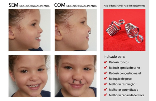 3 Pares Do Melhor Dilatador Nasal Do Mercado P, M Ou G