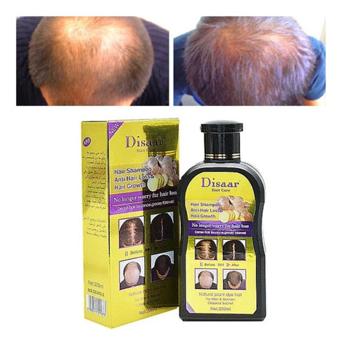 Shampoo Anticaída De Cabello Calvicie Crecimiento D Jengibre