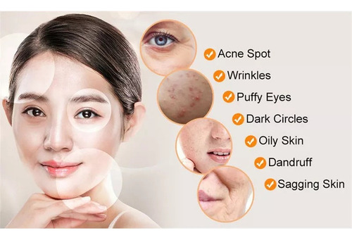 W Equipamento De Alta Frequência Para Cuidados Faciais E