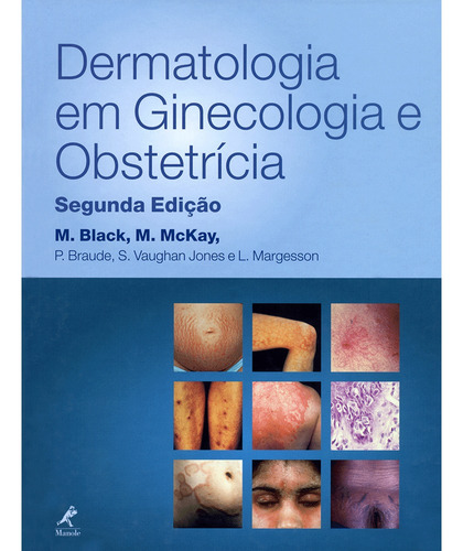 Dermatologia em ginecologia e obstetrícia, de Black, M. Editora Manole LTDA, capa dura em português, 2002