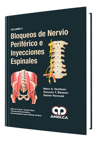Bloqueos De Nervio Periférico E Inyecciones Espinales. 