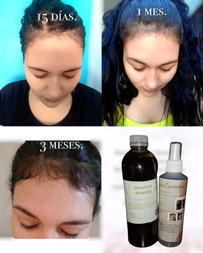 Shampoo De Romero 100% Artesanal Shampoo Romero 100%