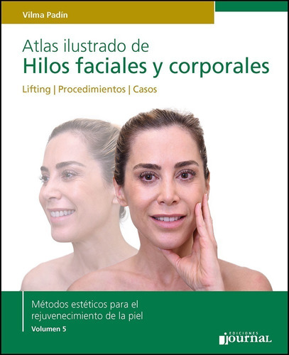 Padin Hilos Faciales Y Corporales Serie Métodos Estéticos V5