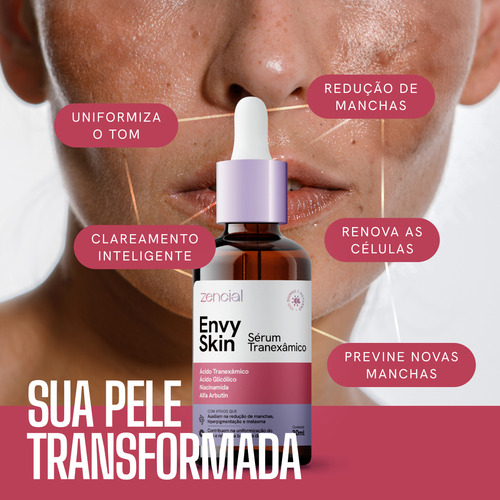 Sérum Facial Melasma E Acne Com Ácido Tranexâmico Acneica Noite