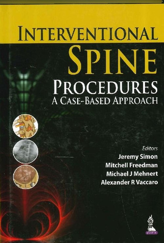 Libro Interventional Spine Procedures De Jeremy Simon Mitche