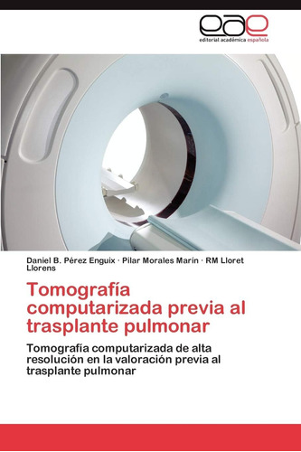 Libro: Tomografía Computarizada Previa Al Trasplante Pulmona